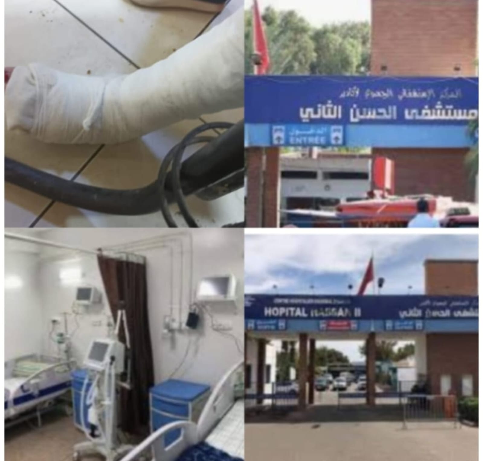 أكادير: تطور ملحوظ في خدمات مستشفى الحسن الثاني